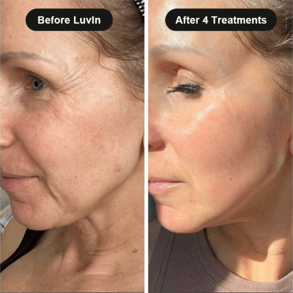 TryLuvin™ Micro Infusion Kit with Peptides - Image 6