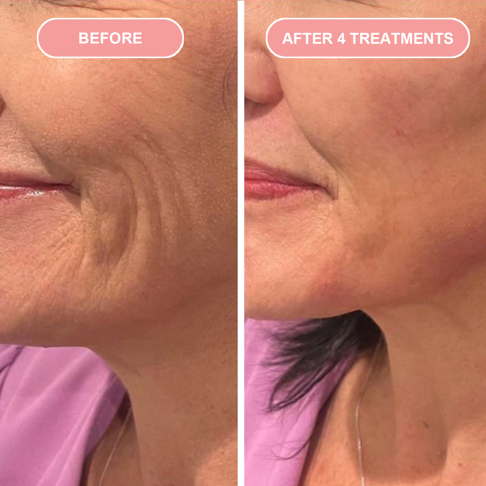 Before & After